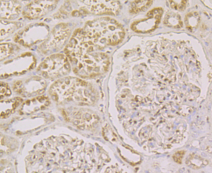 Immunohistochemical analysis of paraffin-embedded human kidney tissue using anti-CLIC1 antibody. The section was pre-treated using heat mediated antigen retrieval with Tris-EDTA buffer (pH 8.0-8.4) for 20 minutes.The tissues were blocked in 5% BSA for 30 minutes at room temperature, washed with ddH2O and PBS, and then probed with the antibody (ER2001-32) at 1/200 dilution, for 30 minutes at room temperature and detected using an HRP conjugated compact polymer system. DAB was used as the chrogen. Counter stained with hematoxylin and mounted with DPX.