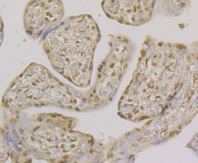 Immunohistochemical analysis of paraffin-embedded human placenta tissue using anti-CLIC1 antibody. The section was pre-treated using heat mediated antigen retrieval with Tris-EDTA buffer (pH 8.0-8.4) for 20 minutes.The tissues were blocked in 5% BSA for 30 minutes at room temperature, washed with ddH2O and PBS, and then probed with the antibody (ER2001-32) at 1/200 dilution, for 30 minutes at room temperature and detected using an HRP conjugated compact polymer system. DAB was used as the chrogen. Counter stained with hematoxylin and mounted with DPX.