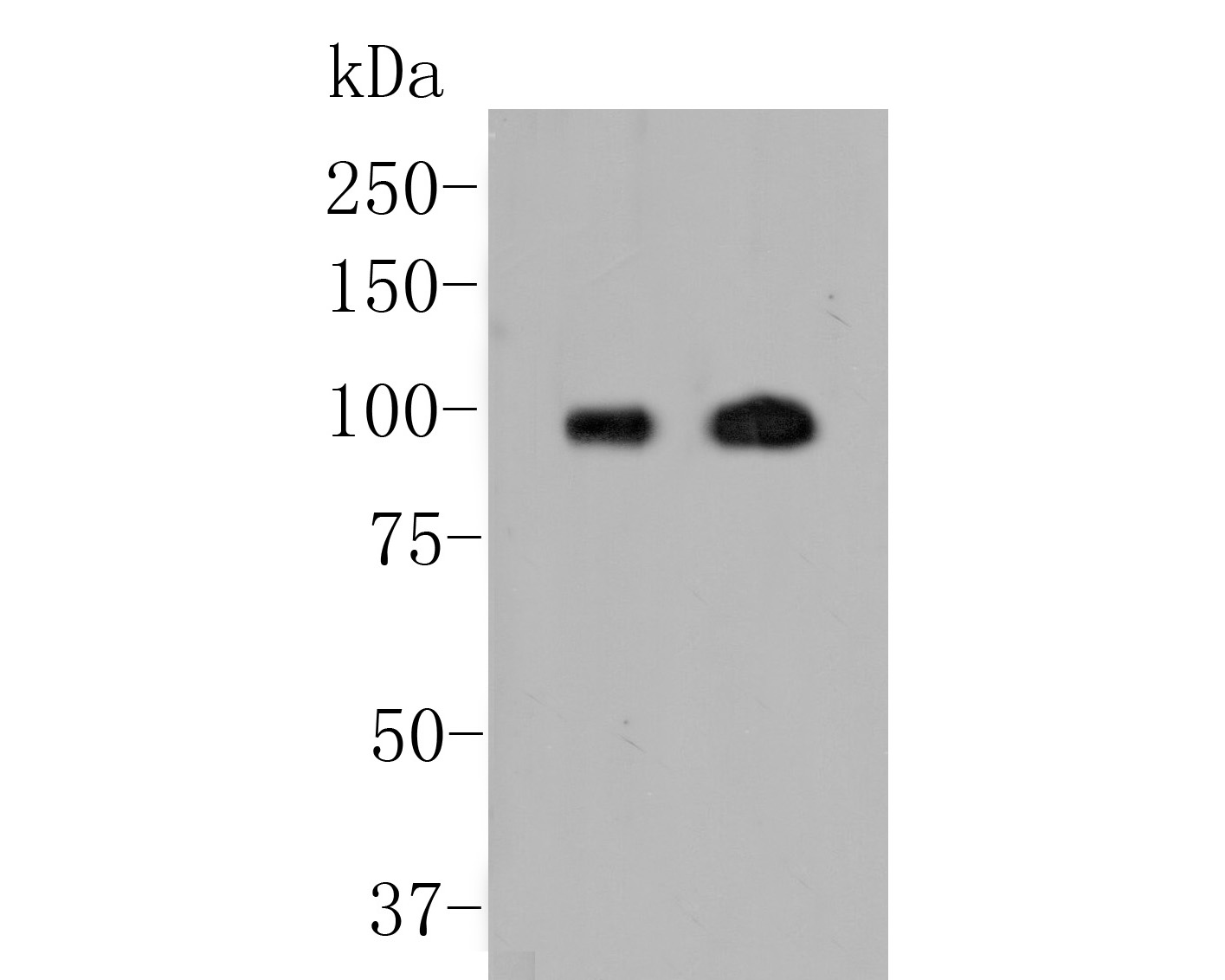 Western blot analysis of Androgen Receptor on different lysates. Proteins were transferred to a PVDF membrane and blocked with 5% BSA in PBS for 1 hour at room temperature. The primary antibody (ER2001-34, 1/500) was used in 5% BSA at room temperature for 2 hours. Goat Anti-Rabbit IgG - HRP Secondary Antibody (HA1001) at 1:5,000 dilution was used for 1 hour at room temperature.<br />
Positive control: <br />
Lane 1: Human skeletal muscle tissue lysate<br />
Lane 2: Rat heart tissue lysate