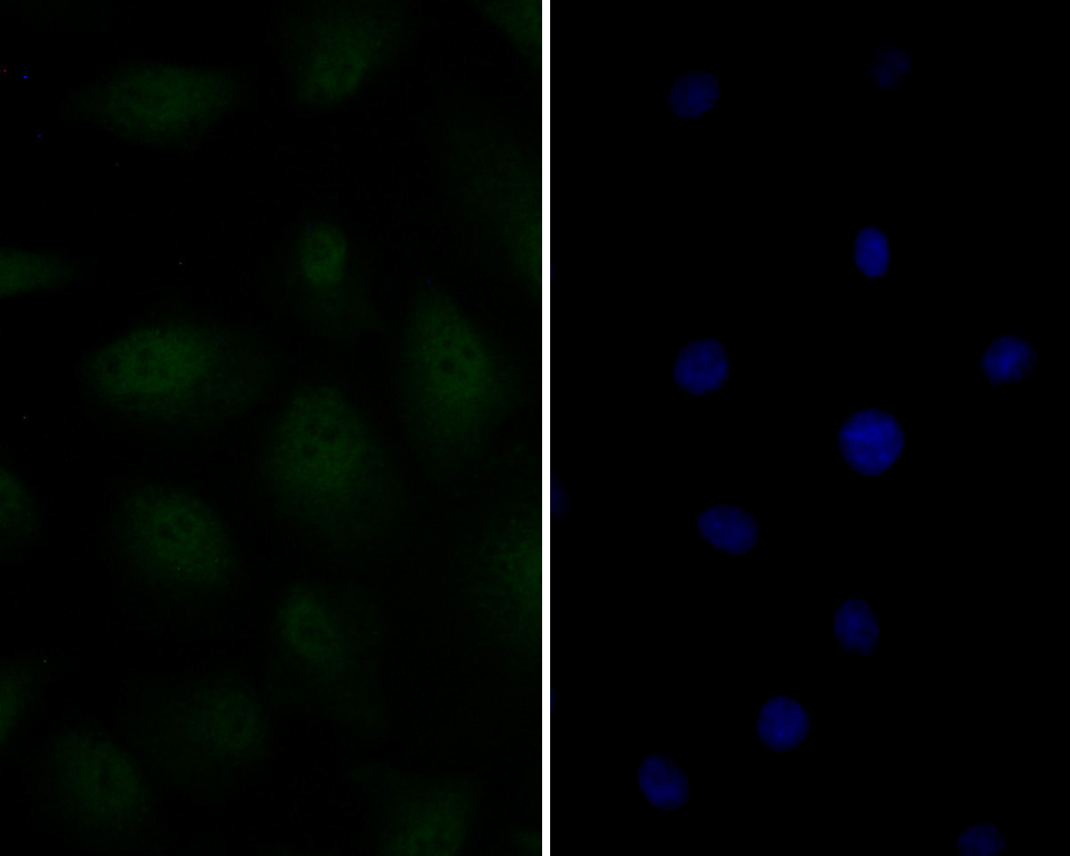 ICC staining of Androgen Receptor in A549 cells (green). Formalin fixed cells were permeabilized with 0.1% Triton X-100 in TBS for 10 minutes at room temperature and blocked with 1% Blocker BSA for 15 minutes at room temperature. Cells were probed with the primary antibody (ER2001-34, 1/50) for 1 hour at room temperature, washed with PBS. Alexa Fluor®488 Goat anti-Rabbit IgG was used as the secondary antibody at 1/100 dilution. The nuclear counter stain is DAPI (blue).
