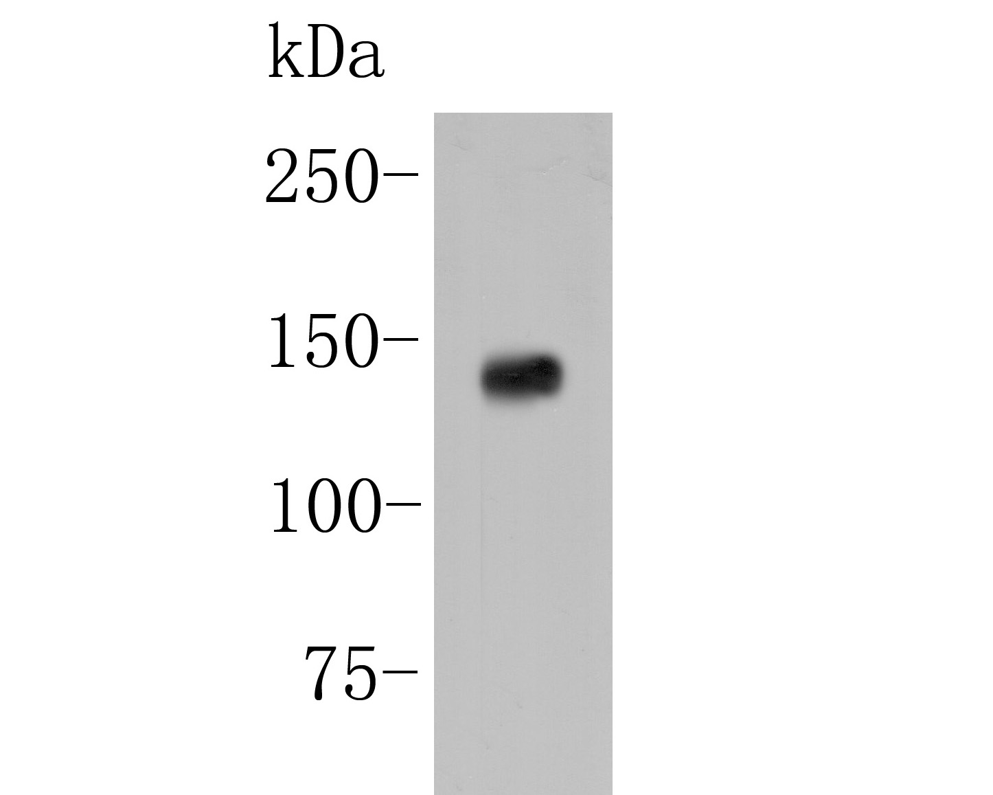 Western blot analysis of IRS1 on rat brain tissue lysate. Proteins were transferred to a PVDF membrane and blocked with 5% BSA in PBS for 1 hour at room temperature. The primary antibody (ER2001-35, 1/500) was used in 5% BSA at room temperature for 2 hours. Goat Anti-Rabbit IgG - HRP Secondary Antibody (HA1001) at 1:5,000 dilution was used for 1 hour at room temperature.