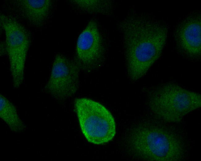 ICC staining of IRS1 in A549 cells (green). Formalin fixed cells were permeabilized with 0.1% Triton X-100 in TBS for 10 minutes at room temperature and blocked with 1% Blocker BSA for 15 minutes at room temperature. Cells were probed with the primary antibody (ER2001-35, 1/100) for 1 hour at room temperature, washed with PBS. Alexa Fluor®488 Goat anti-Rabbit IgG was used as the secondary antibody at 1/100 dilution. The nuclear counter stain is DAPI (blue).
