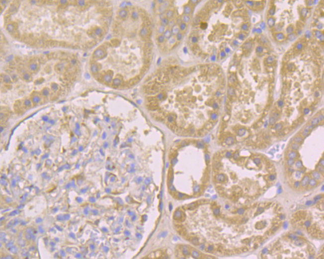 Immunohistochemical analysis of paraffin-embedded human kidney tissue using anti-IRS1 antibody. The section was pre-treated using heat mediated antigen retrieval with Tris-EDTA buffer (pH 8.0-8.4) for 20 minutes.The tissues were blocked in 5% BSA for 30 minutes at room temperature, washed with ddH2O and PBS, and then probed with the primary antibody (ER2001-35, 1/50) for 30 minutes at room temperature. The detection was performed using an HRP conjugated compact polymer system. DAB was used as the chromogen. Tissues were counterstained with hematoxylin and mounted with DPX.