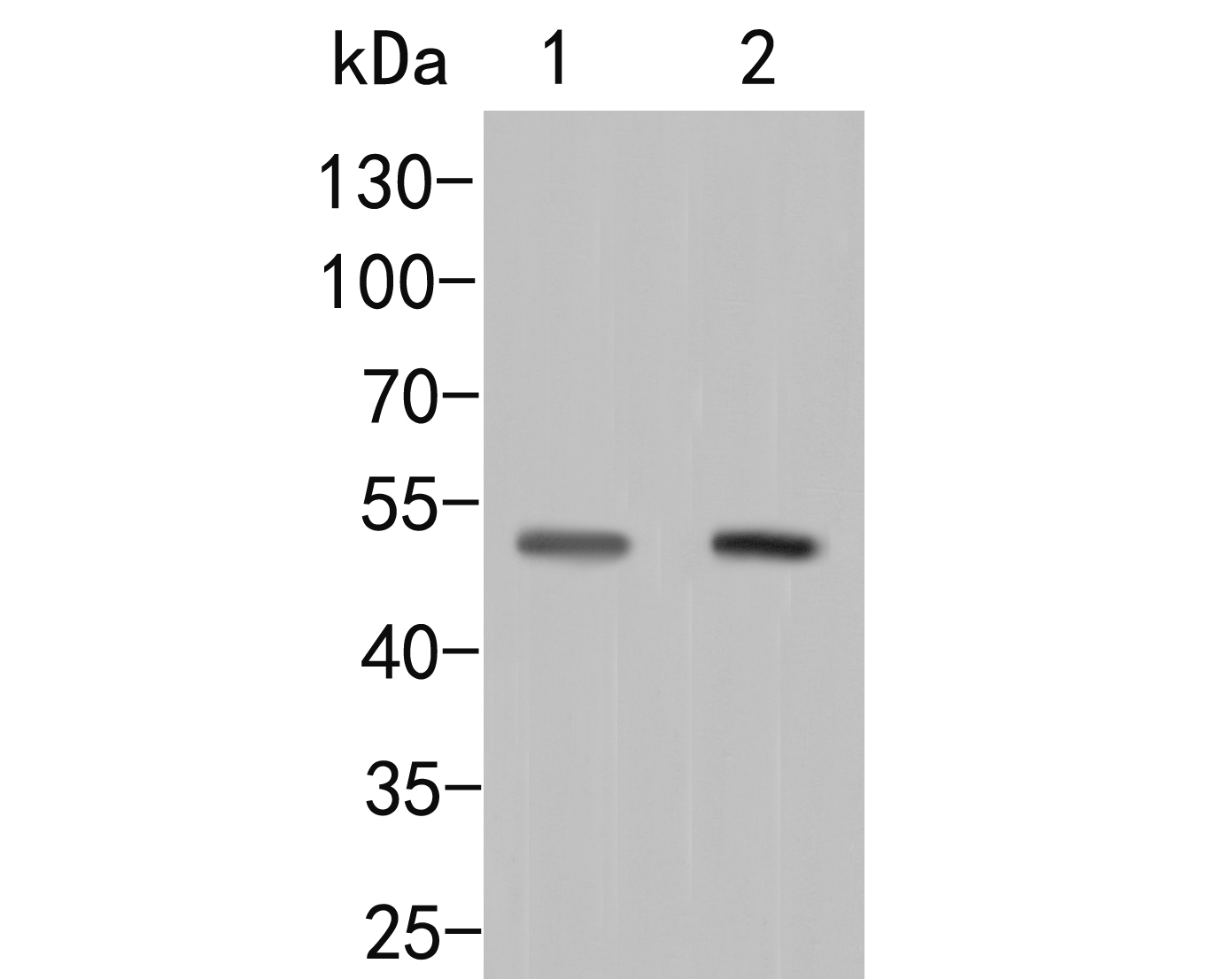 Western blot analysis of P2RX5 on different lysates. Proteins were transferred to a PVDF membrane and blocked with 5% BSA in PBS for 1 hour at room temperature. The primary antibody (ER2001-36, 1/1000) was used in 5% BSA at room temperature for 2 hours. Goat Anti-Rabbit IgG - HRP Secondary Antibody (HA1001) at 1:5,000 dilution was used for 1 hour at room temperature.<br />
Positive control: <br />
Lane 1: Rat brain tissue lysate<br />
Lane 2: Rat heart tissue lysate