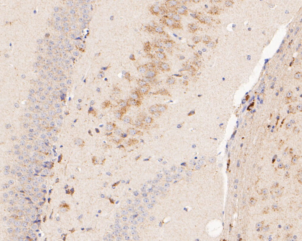 Immunohistochemical analysis of paraffin-embedded mouse brain tissue using anti-P2RX5 antibody. The section was pre-treated using heat mediated antigen retrieval with Tris-EDTA buffer (pH 8.0-8.4) for 20 minutes.The tissues were blocked in 5% BSA for 30 minutes at room temperature, washed with ddH2O and PBS, and then probed with the primary antibody (ER2001-36, 1/200) for 30 minutes at room temperature. The detection was performed using an HRP conjugated compact polymer system. DAB was used as the chromogen. Tissues were counterstained with hematoxylin and mounted with DPX.