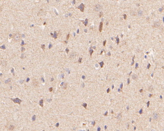 Immunohistochemical analysis of paraffin-embedded rat brain tissue using anti-P2RX5 antibody. The section was pre-treated using heat mediated antigen retrieval with Tris-EDTA buffer (pH 8.0-8.4) for 20 minutes.The tissues were blocked in 5% BSA for 30 minutes at room temperature, washed with ddH2O and PBS, and then probed with the primary antibody (ER2001-36, 1/50) for 30 minutes at room temperature. The detection was performed using an HRP conjugated compact polymer system. DAB was used as the chromogen. Tissues were counterstained with hematoxylin and mounted with DPX.