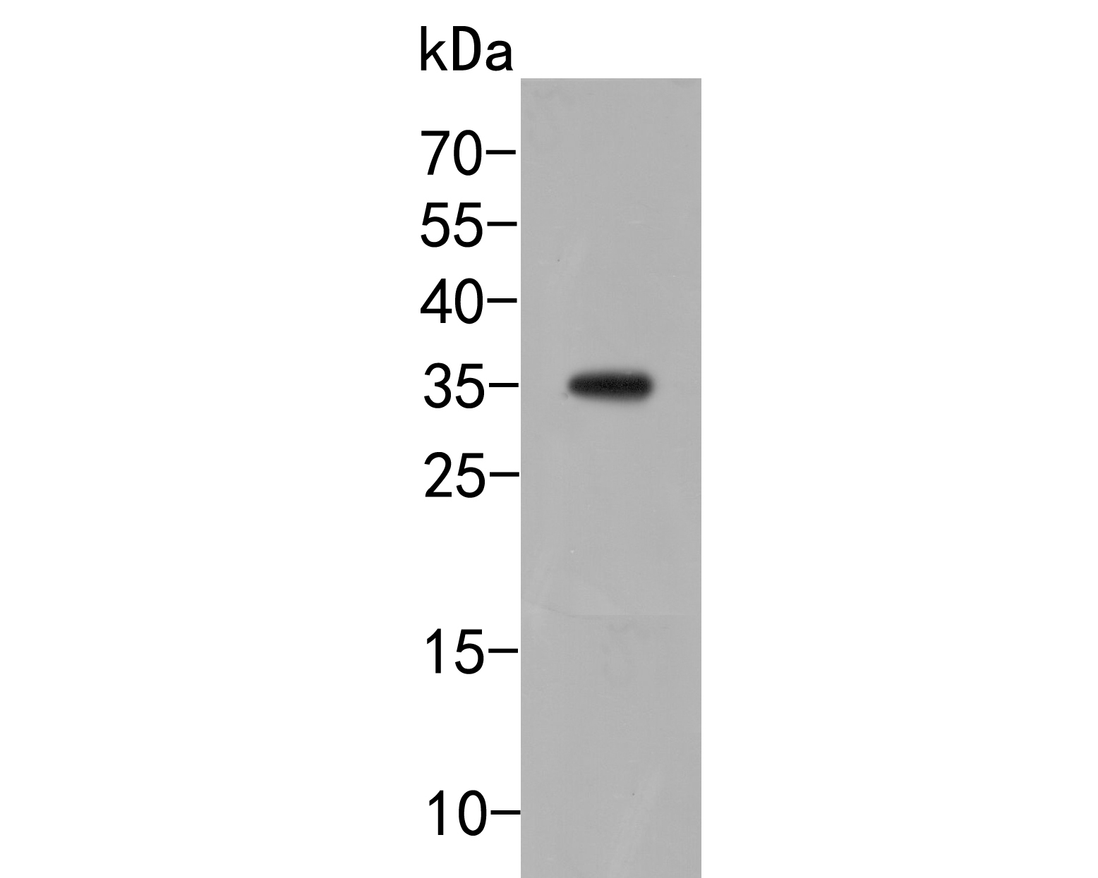 Western blot analysis of TMEM119 on SHSY5Y cell lysate. Proteins were transferred to a PVDF membrane and blocked with 5% BSA in PBS for 1 hour at room temperature. The primary antibody (ER2001-37, 1/500) was used in 5% BSA at room temperature for 2 hours. Goat Anti-Rabbit IgG - HRP Secondary Antibody (HA1001) at 1:5,000 dilution was used for 1 hour at room temperature.