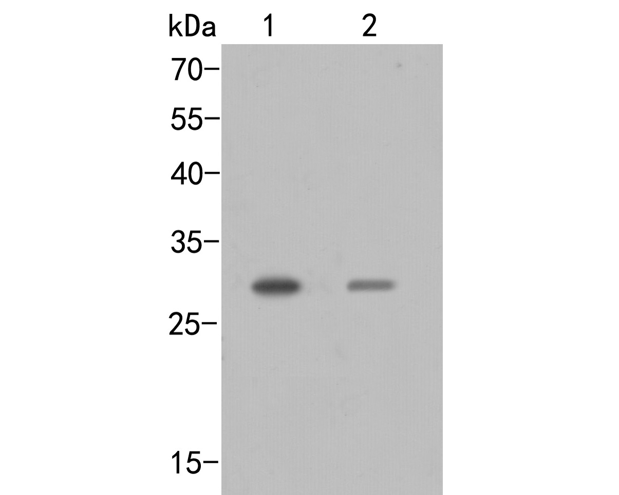 Western blot analysis of SIX2 on different lysates. Proteins were transferred to a PVDF membrane and blocked with 5% BSA in PBS for 1 hour at room temperature. The primary antibody (ER2001-39, 1/500) was used in 5% BSA at room temperature for 2 hours. Goat Anti-Rabbit IgG - HRP Secondary Antibody (HA1001) at 1:5,000 dilution was used for 1 hour at room temperature.<br />
Positive control: <br />
Lane 1: Mouse kidney tissue lysate<br />
Lane 2: Mouse stomach tissue lysate