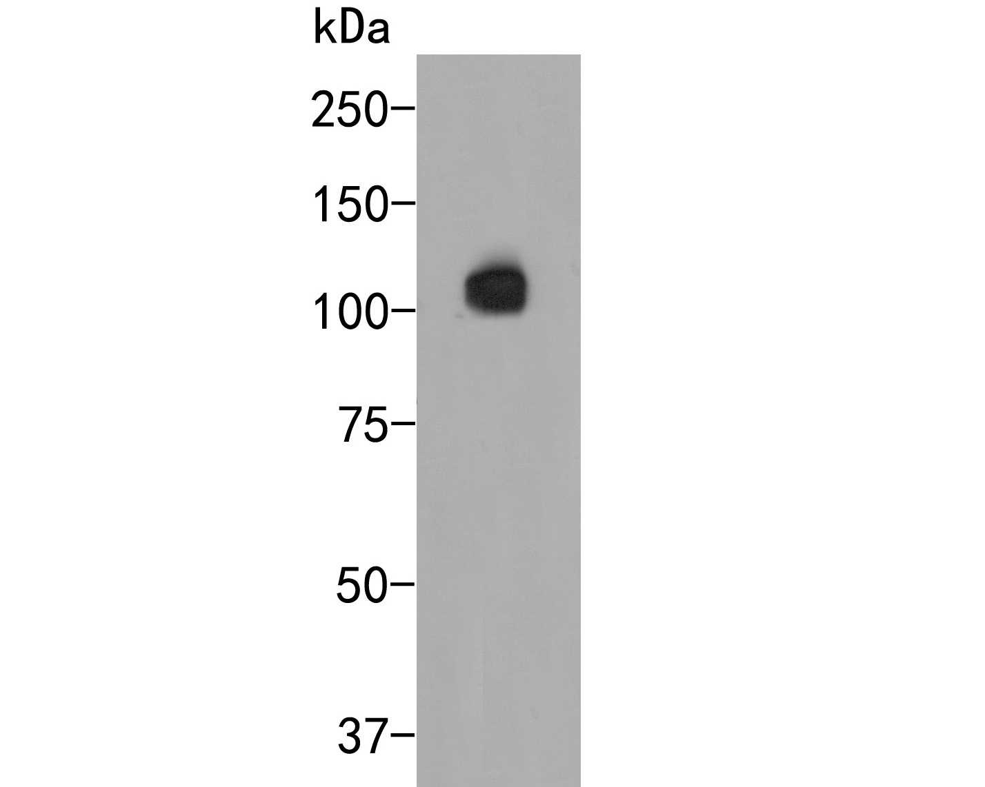 Western blot analysis of Smoothelin on PC-3M cell lysate. Proteins were transferred to a PVDF membrane and blocked with 5% BSA in PBS for 1 hour at room temperature. The primary antibody (ER2001-40, 1/500) was used in 5% BSA at room temperature for 2 hours. Goat Anti-Rabbit IgG - HRP Secondary Antibody (HA1001) at 1:5,000 dilution was used for 1 hour at room temperature.
