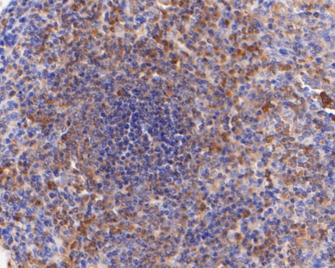 Immunohistochemical analysis of paraffin-embedded human spleen tissue using anti-CD28 antibody. The section was pre-treated using heat mediated antigen retrieval with Tris-EDTA buffer (pH 8.0-8.4) for 20 minutes.The tissues were blocked in 5% BSA for 30 minutes at room temperature, washed with ddH2O and PBS, and then probed with the primary antibody (ER2001-42, 1/400) for 30 minutes at room temperature. The detection was performed using an HRP conjugated compact polymer system. DAB was used as the chromogen. Tissues were counterstained with hematoxylin and mounted with DPX.