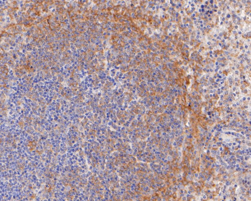 Immunohistochemical analysis of paraffin-embedded mouse spleen tissue using anti-CD28 antibody. The section was pre-treated using heat mediated antigen retrieval with Tris-EDTA buffer (pH 8.0-8.4) for 20 minutes.The tissues were blocked in 5% BSA for 30 minutes at room temperature, washed with ddH2O and PBS, and then probed with the primary antibody (ER2001-42, 1/400) for 30 minutes at room temperature. The detection was performed using an HRP conjugated compact polymer system. DAB was used as the chromogen. Tissues were counterstained with hematoxylin and mounted with DPX.
