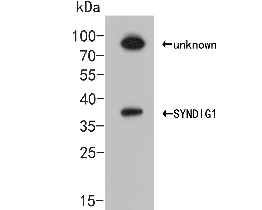 Western blot analysis of SYNDIG1 on 293 cell lysate. Proteins were transferred to a PVDF membrane and blocked with 5% BSA in PBS for 1 hour at room temperature. The primary antibody (ER2001-43, 1/500) was used in 5% BSA at room temperature for 2 hours. Goat Anti-Rabbit IgG - HRP Secondary Antibody (HA1001) at 1:5,000 dilution was used for 1 hour at room temperature.