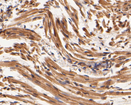 Immunohistochemical analysis of paraffin-embedded human skeletal muscletissue using anti-SYNDIG1 antibody. The section was pre-treated using heat mediated antigen retrieval with Tris-EDTA buffer (pH 8.0-8.4) for 20 minutes.The tissues were blocked in 5% BSA for 30 minutes at room temperature, washed with ddH2O and PBS, and then probed with the primary antibody (ER2001-43, 1/400) for 30 minutes at room temperature. The detection was performed using an HRP conjugated compact polymer system. DAB was used as the chromogen. Tissues were counterstained with hematoxylin and mounted with DPX.