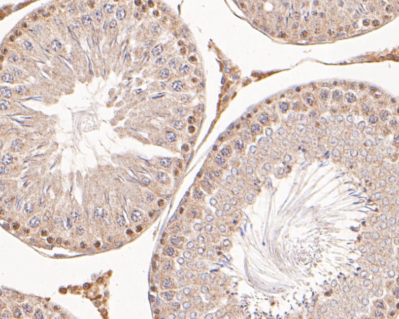 Immunohistochemical analysis of paraffin-embedded rat testis tissue using anti-CBR1 antibody. The section was pre-treated using heat mediated antigen retrieval with Tris-EDTA buffer (pH 8.0-8.4) for 20 minutes.The tissues were blocked in 5% BSA for 30 minutes at room temperature, washed with ddH2O and PBS, and then probed with the primary antibody (ER2001-45, 1/200) for 30 minutes at room temperature. The detection was performed using an HRP conjugated compact polymer system. DAB was used as the chromogen. Tissues were counterstained with hematoxylin and mounted with DPX.