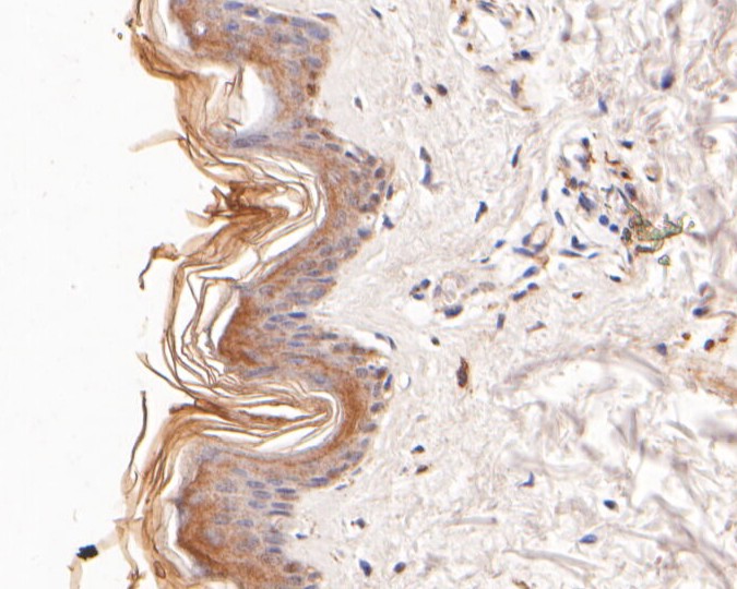 Immunohistochemical analysis of paraffin-embedded human skin tissue using anti-CBR1 antibody. The section was pre-treated using heat mediated antigen retrieval with Tris-EDTA buffer (pH 8.0-8.4) for 20 minutes.The tissues were blocked in 5% BSA for 30 minutes at room temperature, washed with ddH2O and PBS, and then probed with the primary antibody (ER2001-45, 1/800) for 30 minutes at room temperature. The detection was performed using an HRP conjugated compact polymer system. DAB was used as the chromogen. Tissues were counterstained with hematoxylin and mounted with DPX.