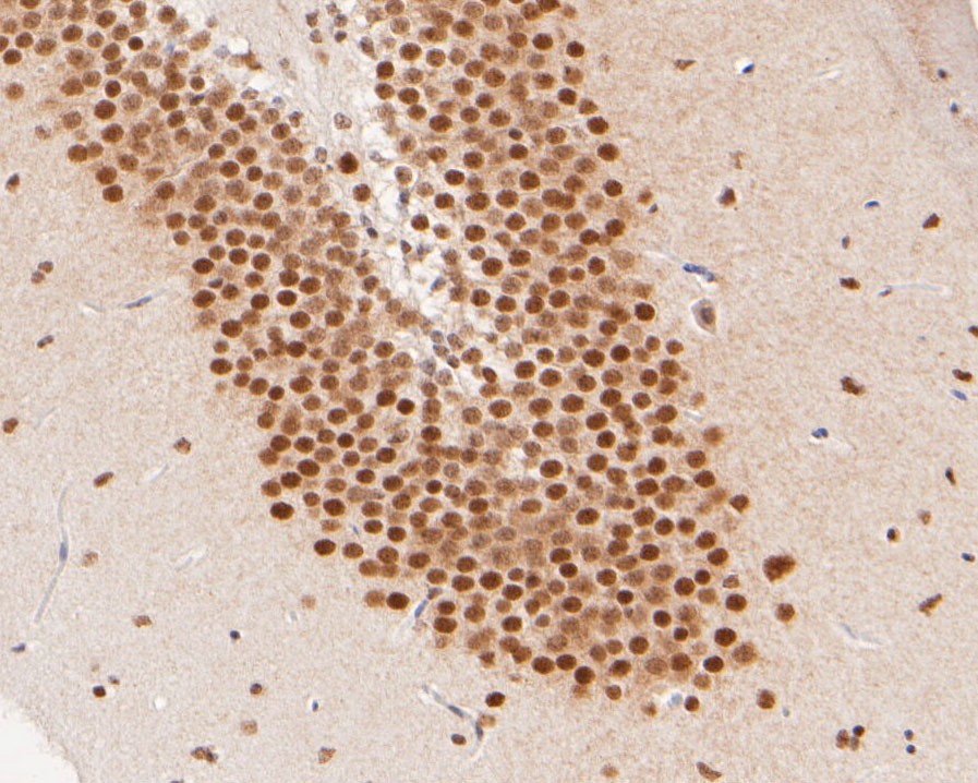 Immunohistochemical analysis of paraffin-embedded mouse brain tissue using anti-Foxk2 antibody. The section was pre-treated using heat mediated antigen retrieval with sodium citrate buffer (pH 6.0) for 20 minutes. The tissues were blocked in 5% BSA for 30 minutes at room temperature, washed with ddH2O and PBS, and then probed with the primary antibody (ER2001-47, 1/500)  for 30 minutes at room temperature. The detection was performed using an HRP conjugated compact polymer system. DAB was used as the chromogen. Tissues were counterstained with hematoxylin and mounted with DPX.