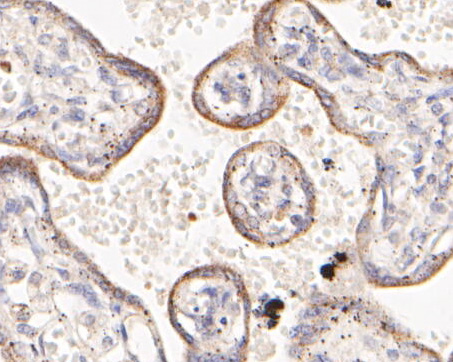 Immunohistochemical analysis of paraffin-embedded human placenta  tissue using anti-HDLBP antibody. The section was pre-treated using heat mediated antigen retrieval with sodium citrate buffer (pH 6.0) for 20 minutes. The tissues were blocked in 5% BSA for 30 minutes at room temperature, washed with ddH2O and PBS, and then probed with the primary antibody (ER2001-48, 1/200)  for 30 minutes at room temperature. The detection was performed using an HRP conjugated compact polymer system. DAB was used as the chromogen. Tissues were counterstained with hematoxylin and mounted with DPX.