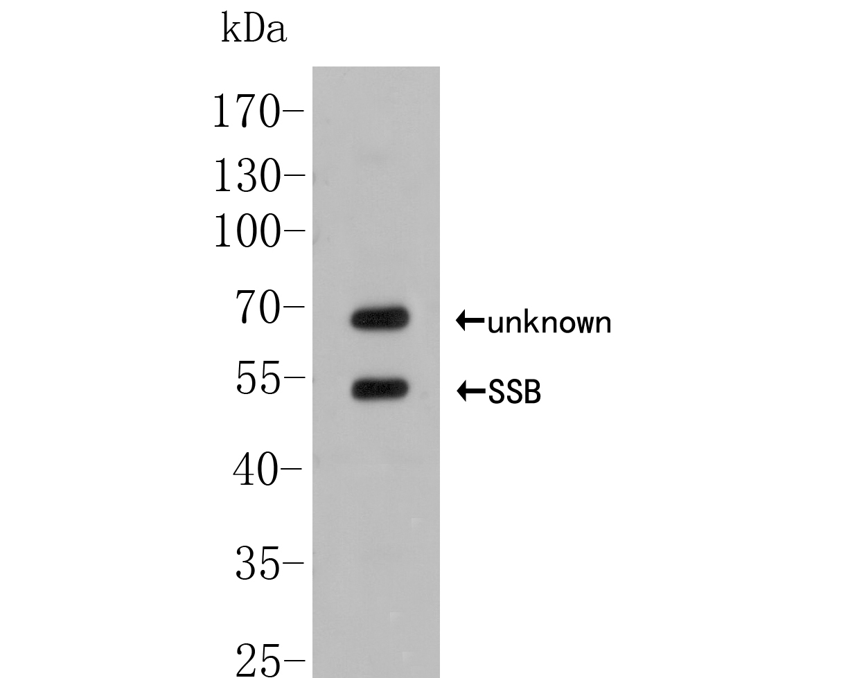 Western blot analysis of SSB on Daudi cell lysate. Proteins were transferred to a PVDF membrane and blocked with 5% BSA in PBS for 1 hour at room temperature. The primary antibody (ER2001-50, 1/500) was used in 5% BSA at room temperature for 2 hours. Goat Anti-Rabbit IgG - HRP Secondary Antibody (HA1001) at 1:5,000 dilution was used for 1 hour at room temperature.