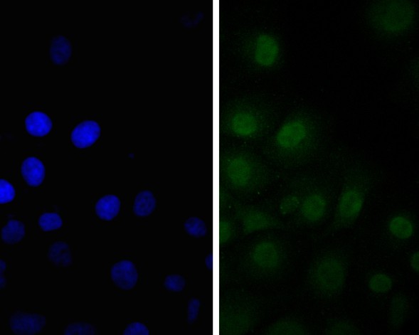 ICC staining of SSB in JAR cells (green). Formalin fixed cells were permeabilized with 0.1% Triton X-100 in TBS for 10 minutes at room temperature and blocked with 1% Blocker BSA for 15 minutes at room temperature. Cells were probed with the primary antibody (ER2001-50, 1/200) for 1 hour at room temperature, washed with PBS. Alexa Fluor®488 Goat anti-Rabbit IgG was used as the secondary antibody at 1/1,000 dilution. The nuclear counter stain is DAPI (blue).