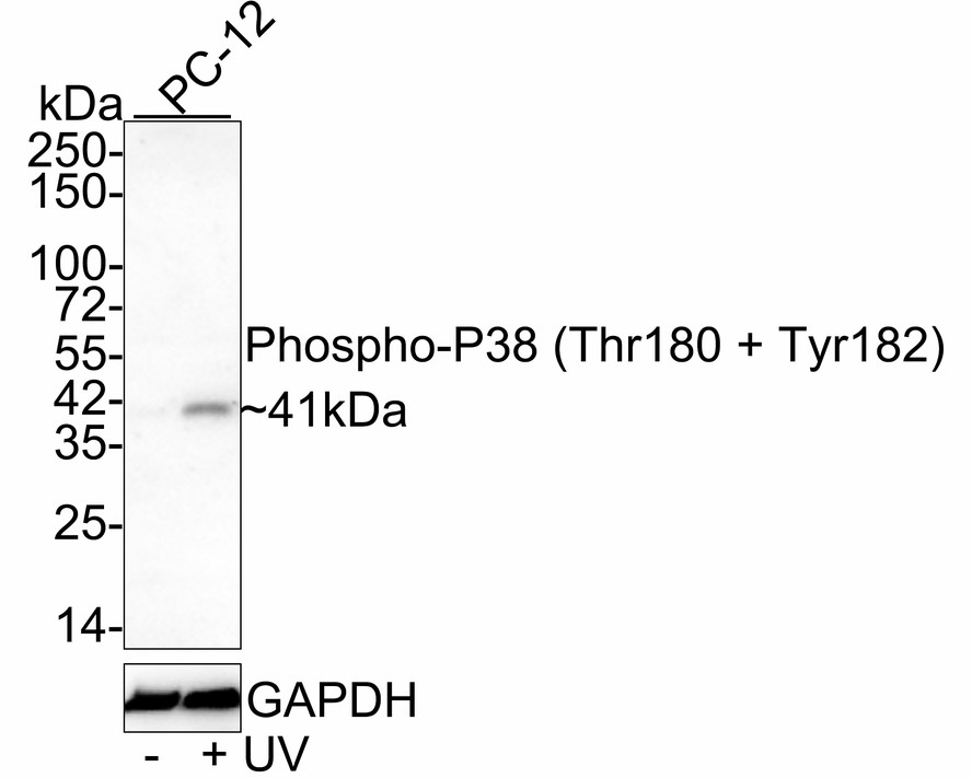 Western blot analysis of Phospho-P38  (Thr180 + Tyr182) on different lysates. Proteins were transferred to a PVDF membrane and blocked with 5% BSA in PBS for 1 hour at room temperature. The primary antibody (ER2001-52, 1/1000) was used in 5% BSA at room temperature for 2 hours. Goat Anti-Rabbit IgG - HRP Secondary Antibody (HA1001) at 1:5,000 dilution was used for 1 hour at room temperature.<br />
Positive control: <br />
Lane 1: 293 cell lysate, untreated with UV<br />
Lane 2: 293 cell lysate, treated with UV for 60 minutes