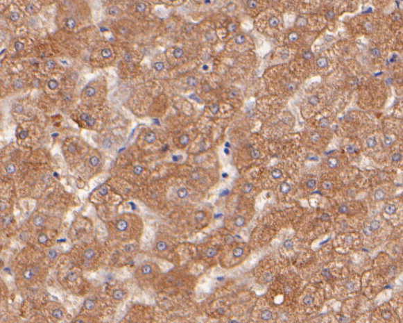 Immunohistochemical analysis of paraffin-embedded human liver tissue using anti-Transferrin antibody. The section was pre-treated using heat mediated antigen retrieval with Tris-EDTA buffer (pH 8.0-8.4) for 20 minutes.The tissues were blocked in 5% BSA for 30 minutes at room temperature, washed with ddH2O and PBS, and then probed with the primary antibody (ER2001-53, 1/400) for 30 minutes at room temperature. The detection was performed using an HRP conjugated compact polymer system. DAB was used as the chromogen. Tissues were counterstained with hematoxylin and mounted with DPX.