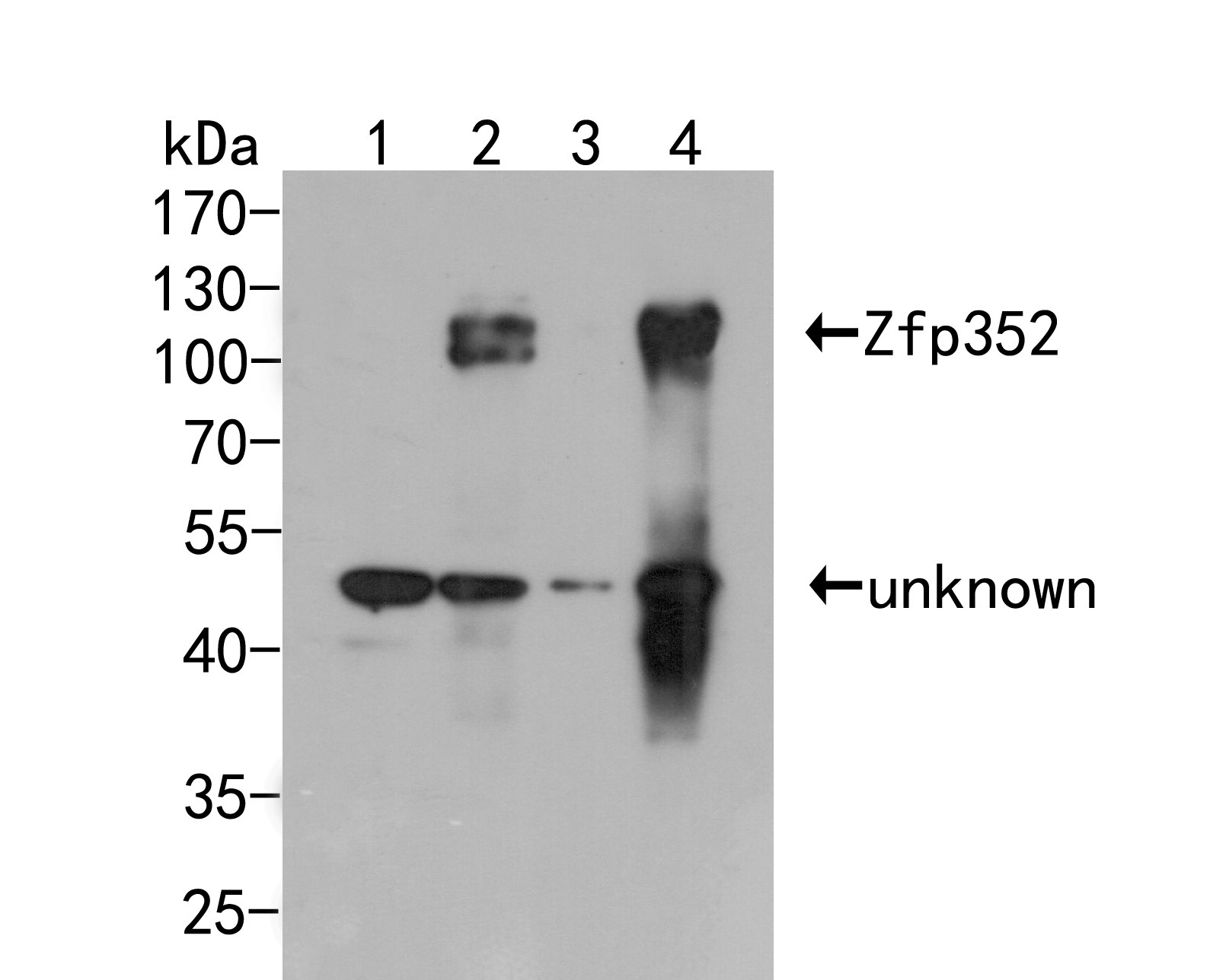 Western blot analysis of Zfp352 on different lysates. Proteins were transferred to a PVDF membrane and blocked with 5% BSA in PBS for 1 hour at room temperature. The primary antibody (ER2001-55, 1/1000) was used in 5% BSA at room temperature for 2 hours. Goat Anti-Rabbit IgG - HRP Secondary Antibody (HA1001) at 1:5,000 dilution was used for 1 hour at room temperature.<br />
Positive control:<br />
Lane 1: Non-transfected 293T cells lysate<br />
Lane 2: GFP-tagged Zfp352 transfected 293T cells lysate<br />
Lane 3: Non-transfected 293F cells lysate<br />
Lane 4: GFP-tagged Zfp352 transfected 293F cells lysate