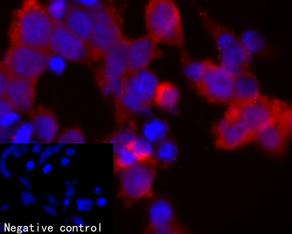 ICC staining of Zfp352 in Non-transfected 293T cells and GFP-tagged Zfp352 transfected 293T cells (red). Formalin fixed cells were permeabilized with 0.1% Triton X-100 in TBS for 10 minutes at room temperature and blocked with 1% Blocker BSA for 15 minutes at room temperature. Cells were probed with the primary antibody (ER2001-55, 1/50) for 1 hour at room temperature, washed with PBS. Alexa Fluor®594 Goat anti-Rabbit IgG was used as the secondary antibody at 1/100 dilution. The nuclear counter stain is DAPI (blue).