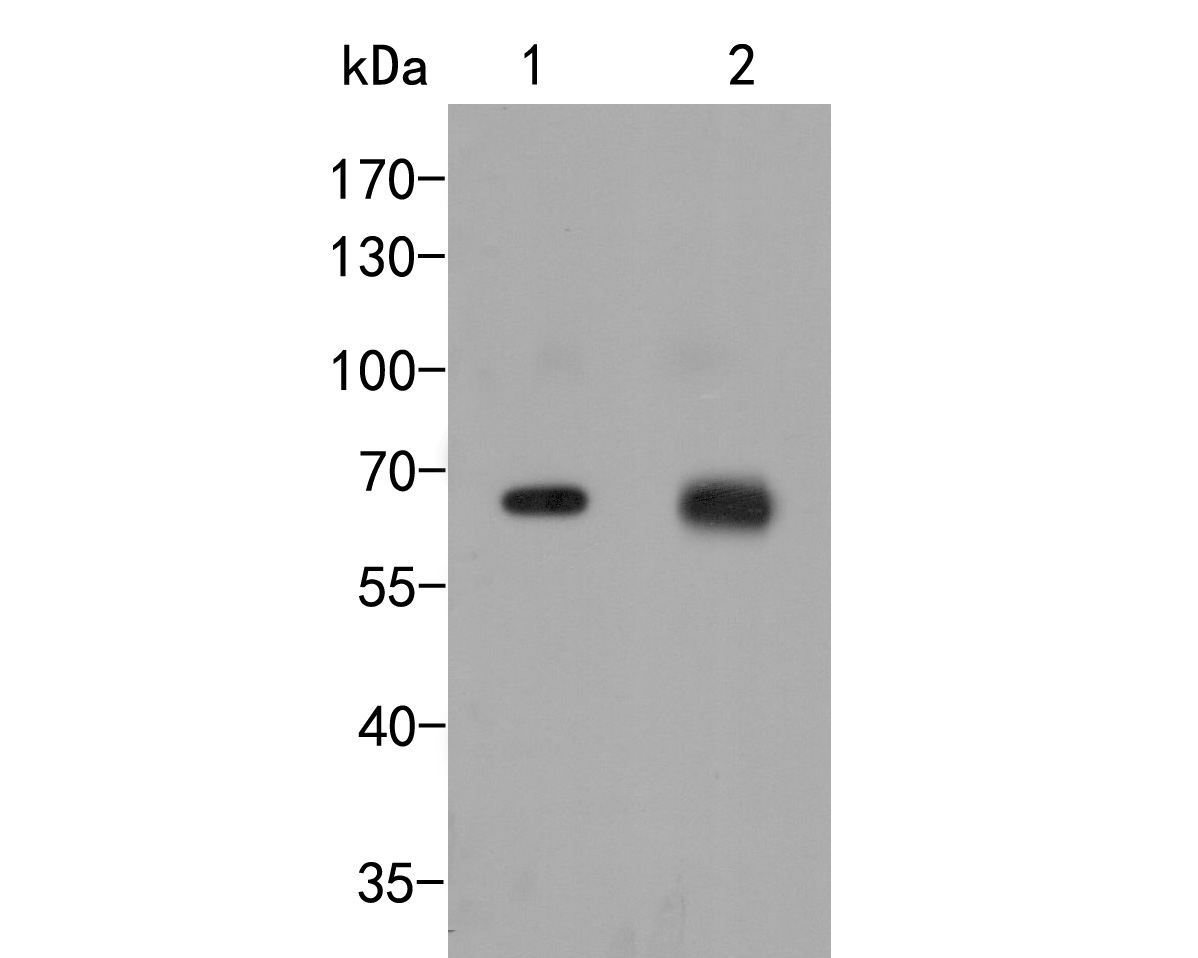 Western blot analysis of Nucleoporin p62 on different lysates. Proteins were transferred to a PVDF membrane and blocked with 5% BSA in PBS for 1 hour at room temperature. The primary antibody (ER2001-57, 1/500) was used in 5% BSA at room temperature for 2 hours. Goat Anti-Rabbit IgG - HRP Secondary Antibody (HA1001) at 1:5,000 dilution was used for 1 hour at room temperature.<br />
Positive control: <br />
Lane 1: K562 cell lysate<br />
Lane 2: A431 cell lysate