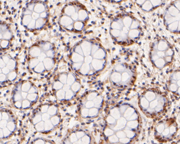 Immunohistochemical analysis of paraffin-embedded human rectum tissue using anti-Nucleoporin p62 antibody. The section was pre-treated using heat mediated antigen retrieval with sodium citrate buffer (pH 6.0) for 20 minutes. The tissues were blocked in 5% BSA for 30 minutes at room temperature, washed with ddH2O and PBS, and then probed with the primary antibody (ER2001-57, 1/100)  for 30 minutes at room temperature. The detection was performed using an HRP conjugated compact polymer system. DAB was used as the chromogen. Tissues were counterstained with hematoxylin and mounted with DPX.