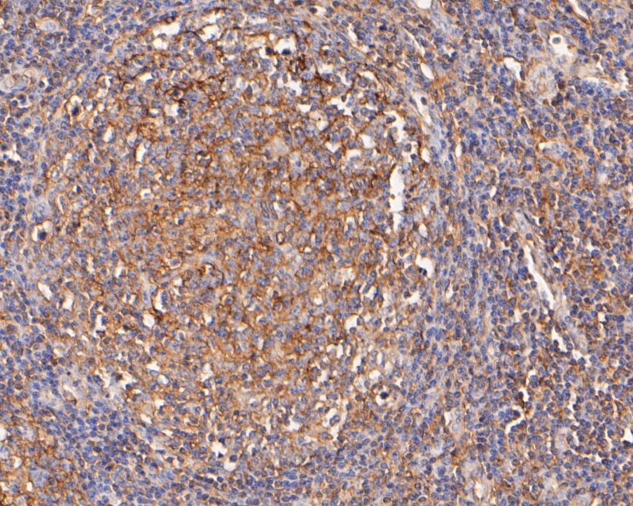 Immunohistochemical analysis of paraffin-embedded human tonsil tissue using anti-Clusterin antibody. The section was pre-treated using heat mediated antigen retrieval with Tris-EDTA buffer (pH 8.0-8.4) for 20 minutes.The tissues were blocked in 5% BSA for 30 minutes at room temperature, washed with ddH2O and PBS, and then probed with the primary antibody (ER2001-58, 1/400) for 30 minutes at room temperature. The detection was performed using an HRP conjugated compact polymer system. DAB was used as the chromogen. Tissues were counterstained with hematoxylin and mounted with DPX.