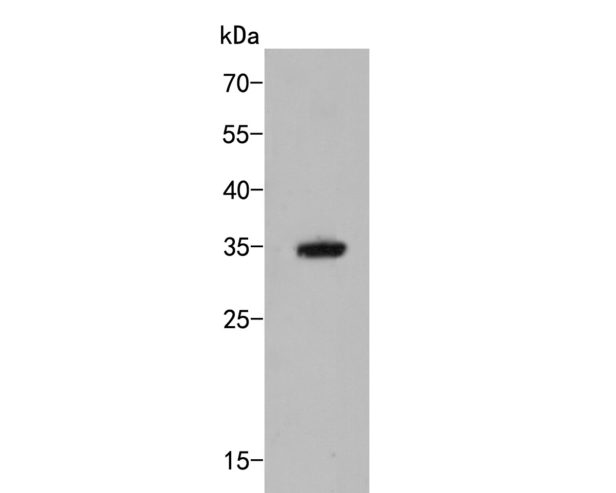 Western blot analysis of MTHFD2 on 293 cell  lysates. Proteins were transferred to a PVDF membrane and blocked with 5% BSA in PBS for 1 hour at room temperature. The primary antibody (ER2001-62, 1/500) was used in 5% BSA at room temperature for 2 hours. Goat Anti-Rabbit IgG - HRP Secondary Antibody (HA1001) at 1:5,000 dilution was used for 1 hour at room temperature.