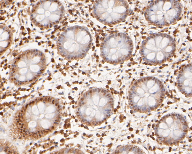 Immunohistochemical analysis of paraffin-embedded human colon tissue using anti-Cullin 4B antibody. The section was pre-treated using heat mediated antigen retrieval with sodium citrate buffer (pH 6.0) for 20 minutes. The tissues were blocked in 5% BSA for 30 minutes at room temperature, washed with ddH2O and PBS, and then probed with the primary antibody (ER2001-65, 1/500)  for 30 minutes at room temperature. The detection was performed using an HRP conjugated compact polymer system. DAB was used as the chromogen. Tissues were counterstained with hematoxylin and mounted with DPX.