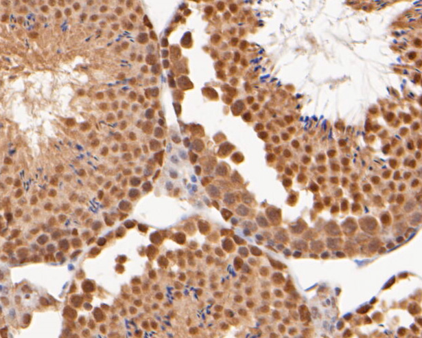 Immunohistochemical analysis of paraffin-embedded mouse testis tissue using anti-Cullin 4B antibody. The section was pre-treated using heat mediated antigen retrieval with sodium citrate buffer (pH 6.0) for 20 minutes. The tissues were blocked in 5% BSA for 30 minutes at room temperature, washed with ddH2O and PBS, and then probed with the primary antibody (ER2001-65, 1/1000)  for 30 minutes at room temperature. The detection was performed using an HRP conjugated compact polymer system. DAB was used as the chromogen. Tissues were counterstained with hematoxylin and mounted with DPX.