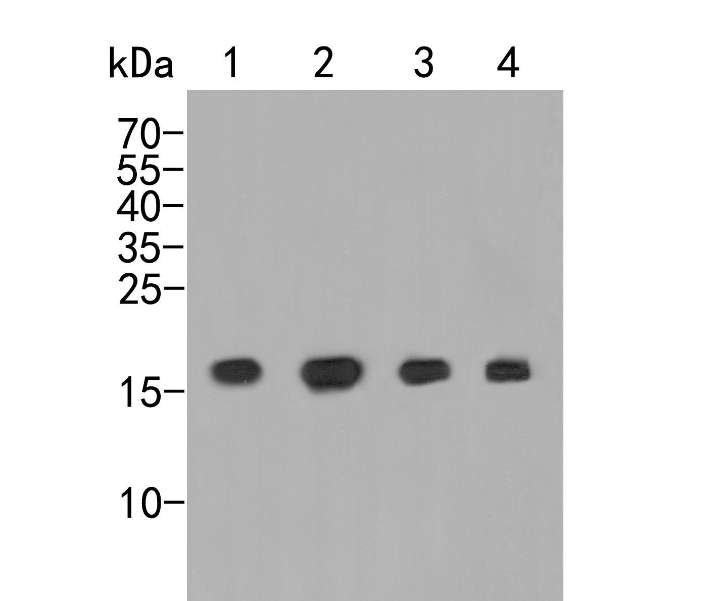 Western blot analysis of hNaa50p on different lysates. Proteins were transferred to a PVDF membrane and blocked with 5% BSA in PBS for 1 hour at room temperature. The primary antibody (ER2001-66, 1/500) was used in 5% BSA at room temperature for 2 hours. Goat Anti-Rabbit IgG - HRP Secondary Antibody (HA1001) at 1:5,000 dilution was used for 1 hour at room temperature.<br />
Positive control: <br />
Lane 1: A431 cell lysate<br />
Lane 2: Hela cell lysate<br />
Lane 3: Mouse stomach tissue lysate<br />
Lane 4: Rat cerebellum tissue lysate