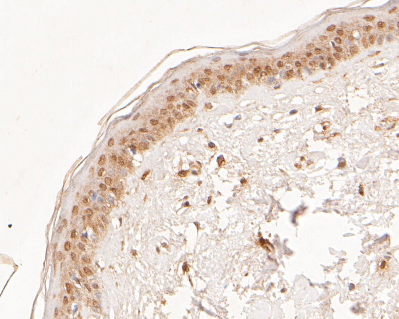 Immunohistochemical analysis of paraffin-embedded human skin tissue using anti-hNaa50p antibody. The section was pre-treated using heat mediated antigen retrieval with sodium citrate buffer (pH 6.0) for 20 minutes. The tissues were blocked in 5% BSA for 30 minutes at room temperature, washed with ddH2O and PBS, and then probed with the primary antibody (ER2001-66, 1/500)  for 30 minutes at room temperature. The detection was performed using an HRP conjugated compact polymer system. DAB was used as the chromogen. Tissues were counterstained with hematoxylin and mounted with DPX.