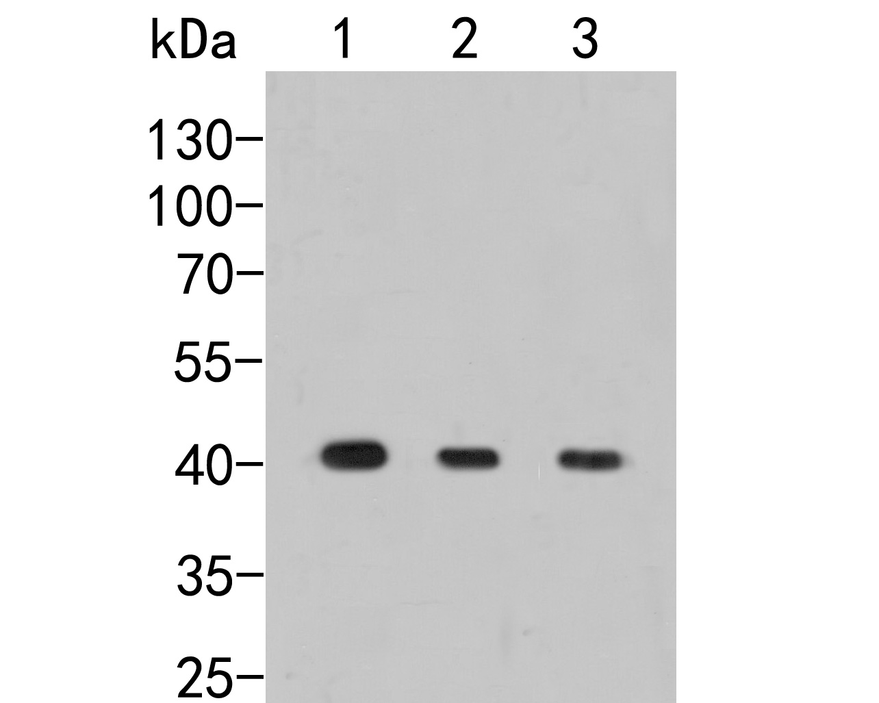 Western blot analysis of Pleckstrin on different lysates. Proteins were transferred to a PVDF membrane and blocked with 5% BSA in PBS for 1 hour at room temperature. The primary antibody (ER2001-67, 1/1000) was used in 5% BSA at room temperature for 2 hours. Goat Anti-Rabbit IgG - HRP Secondary Antibody (HA1001) at 1:5,000 dilution was used for 1 hour at room temperature.<br />
Positive control: <br />
Lane 1: U937 cell lysate<br />
Lane 2: Rat spleen tissue lysate<br />
Lane 2: Mouse brain tissue lysate