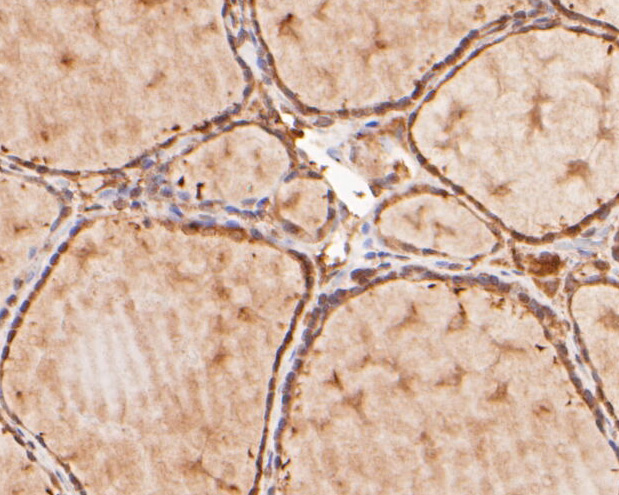 Immunohistochemical analysis of paraffin-embedded human thyroid tissue using anti-KIFAP3 antibody. The section was pre-treated using heat mediated antigen retrieval with sodium citrate buffer (pH 6.0) for 20 minutes. The tissues were blocked in 5% BSA for 30 minutes at room temperature, washed with ddH2O and PBS, and then probed with the primary antibody (ER2001-69, 1/400)  for 30 minutes at room temperature. The detection was performed using an HRP conjugated compact polymer system. DAB was used as the chromogen. Tissues were counterstained with hematoxylin and mounted with DPX.