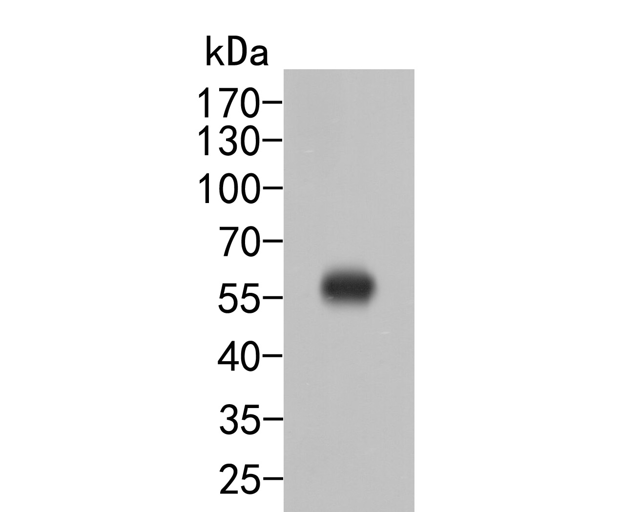 Western blot analysis of SerpinA6 on human placenta tissue lysates. Proteins were transferred to a PVDF membrane and blocked with 5% BSA in PBS for 1 hour at room temperature. The primary antibody (ER2001-70, 1/500) was used in 5% BSA at room temperature for 2 hours. Goat Anti-Rabbit IgG - HRP Secondary Antibody (HA1001) at 1:5,000 dilution was used for 1 hour at room temperature.