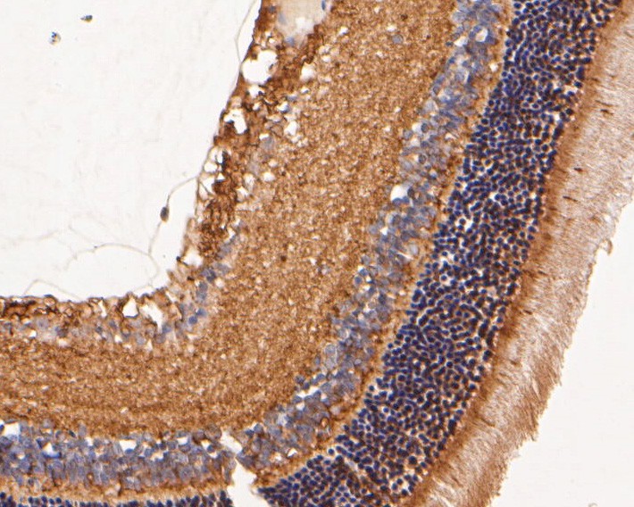 Immunohistochemical analysis of paraffin-embedded rat eyeball tissue using anti-GRK1 antibody. The section was pre-treated using heat mediated antigen retrieval with Tris-EDTA buffer (pH 8.0-8.4) for 20 minutes.The tissues were blocked in 5% BSA for 30 minutes at room temperature, washed with ddH2O and PBS, and then probed with the primary antibody (ER2001-72, 1/400) for 30 minutes at room temperature. The detection was performed using an HRP conjugated compact polymer system. DAB was used as the chromogen. Tissues were counterstained with hematoxylin and mounted with DPX.