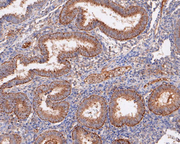 Immunohistochemical analysis of paraffin-embedded human uterus tissue with Rabbit anti-PLAP antibody (ET7111-06) at 1/50 dilution.<br />
<br />
The section was pre-treated using heat mediated antigen retrieval with sodium citrate buffer (pH 6.0) for 2 minutes. The tissues were blocked in 1% BSA for 20 minutes at room temperature, washed with ddH2O and PBS, and then probed with the primary antibody (ET7111-06) at 1/50 dilution for 1 hour at room temperature. The detection was performed using an HRP conjugated compact polymer system. DAB was used as the chromogen. Tissues were counterstained with hematoxylin and mounted with DPX.