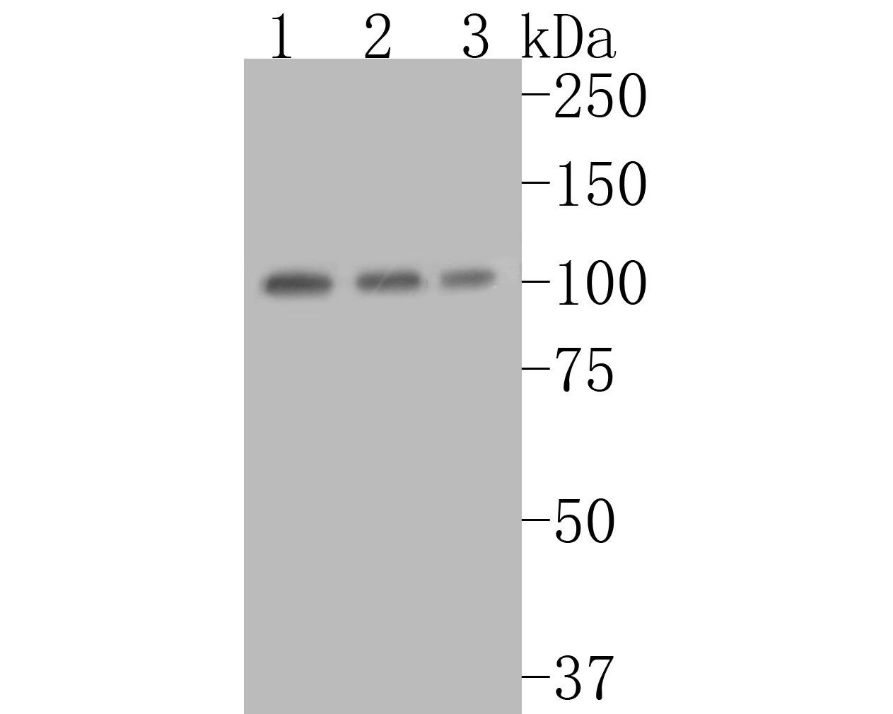 Western blot analysis of CTNNA3 on different lysates with Rabbit anti-CTNNA3 antibody (ET7111-07) at 1/1,000 dilution.<br />
<br />
Lane 1: Rat heart tissue lysate<br />
Lane 2: Mouse heart tissue lysate<br />
Lane 3: 293 cell lysate (10 µg/Lane)<br />
<br />
Lysates/proteins at 20 µg/Lane.<br />
<br />
Predicted band size: 100 kDa<br />
Observed band size: 100 kDa<br />
<br />
Exposure time: 2 minutes;<br />
<br />
8% SDS-PAGE gel.<br />
<br />
Proteins were transferred to a PVDF membrane and blocked with 5% NFDM/TBST for 1 hour at room temperature. The primary antibody (ET7111-07) at 1/1,000 dilution was used in 5% NFDM/TBST at room temperature for 2 hours. Goat Anti-Rabbit IgG - HRP Secondary Antibody (HA1001) at 1:5,000 dilution was used for 1 hour at room temperature.