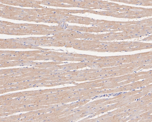 Immunohistochemical analysis of paraffin-embedded rat heart tissue with Rabbit anti-CTNNA3 antibody (ET7111-07) at 1/50 dilution.<br />
<br />
The section was pre-treated using heat mediated antigen retrieval with Tris-EDTA buffer (pH 6.0)) for 20 minutes. The tissues were blocked in 1% BSA for 20 minutes at room temperature, washed with ddH2O and PBS, and then probed with the primary antibody (ET7111-07) at 1/50 dilution for 0.5 hour at room temperature. The detection was performed using an HRP conjugated compact polymer system. DAB was used as the chromogen. Tissues were counterstained with hematoxylin and mounted with DPX.