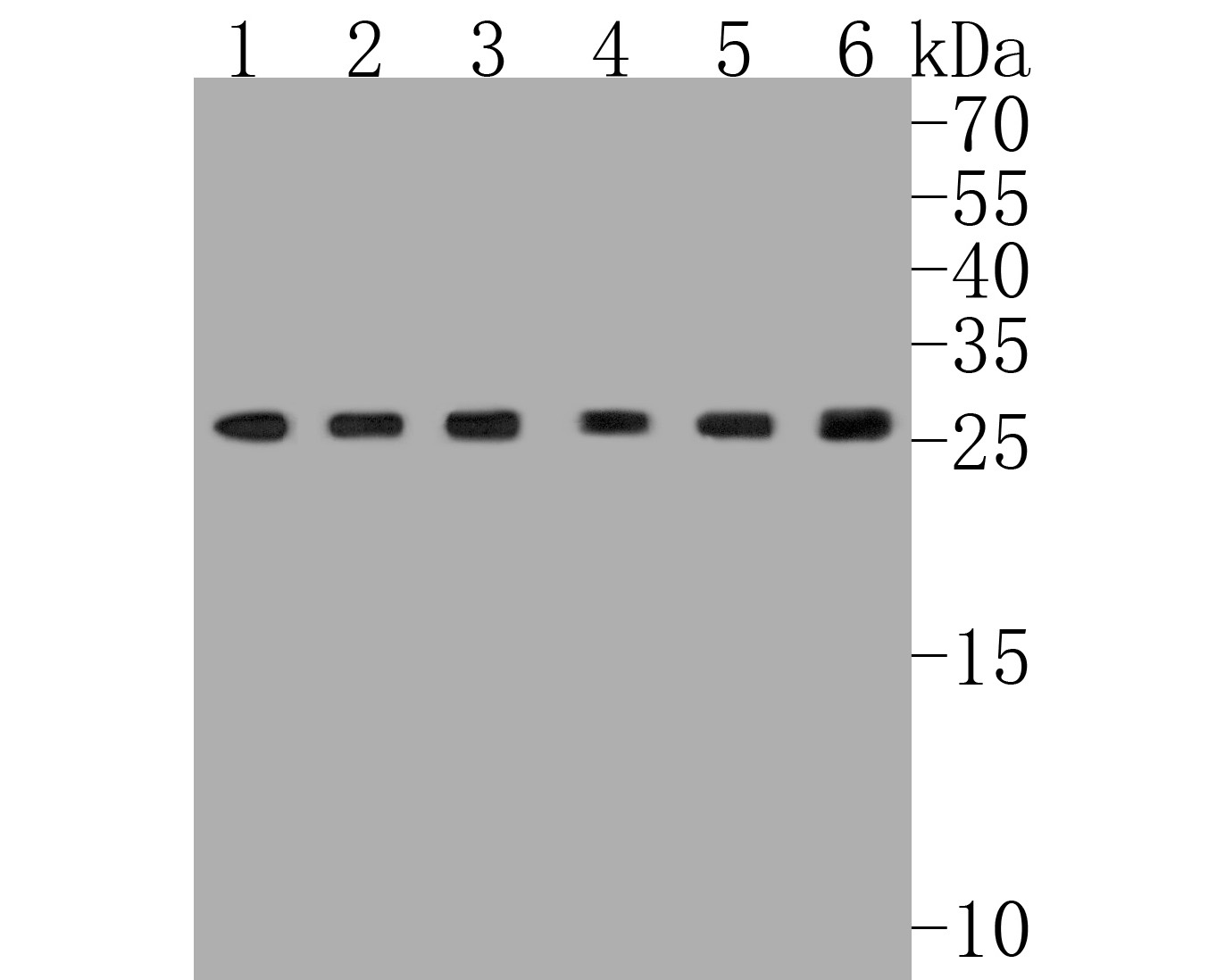 Western blot analysis of GTF2F2 on different lysates with Rabbit anti-GTF2F2 antibody (ET7111-08) at 1/1,000 dilution.<br />
<br />
Lane 1: Rat testis tissue lysate<br />
Lane 2: A549 cell lysate<br />
Lane 3: HepG2 cell lysate<br />
Lane 4: HL-60 cell lysate<br />
Lane 5: THP-1 cell lysate<br />
Lane 6: Daudi cell lysate<br />
<br />
Lysates/proteins at 10 µg/Lane.<br />
<br />
Predicted band size: 28 kDa<br />
Observed band size: 28 kDa<br />
<br />
Exposure time: 2 minutes;<br />
<br />
15% SDS-PAGE gel.<br />
<br />
Proteins were transferred to a PVDF membrane and blocked with 5% NFDM/TBST for 1 hour at room temperature. The primary antibody (ET7111-08) at 1/1,000 dilution was used in 5% NFDM/TBST at room temperature for 2 hours. Goat Anti-Rabbit IgG - HRP Secondary Antibody (HA1001) at 1:5,000 dilution was used for 1 hour at room temperature.
