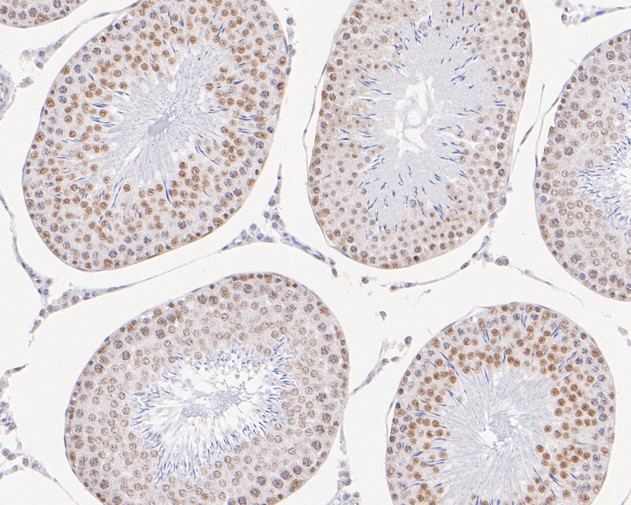 Immunohistochemical analysis of paraffin-embedded rat testis  tissue with Rabbit anti-GTF2F2 antibody (ET7111-08) at 1/50 dilution.<br />
<br />
The section was pre-treated using heat mediated antigen retrieval with sodium citrate buffer (pH 6.0) for 2 minutes. The tissues were blocked in 1% BSA for 20 minutes at room temperature, washed with ddH2O and PBS, and then probed with the primary antibody (ET7111-08) at 1/50 dilution for 1 hour at room temperature. The detection was performed using an HRP conjugated compact polymer system. DAB was used as the chromogen. Tissues were counterstained with hematoxylin and mounted with DPX.
