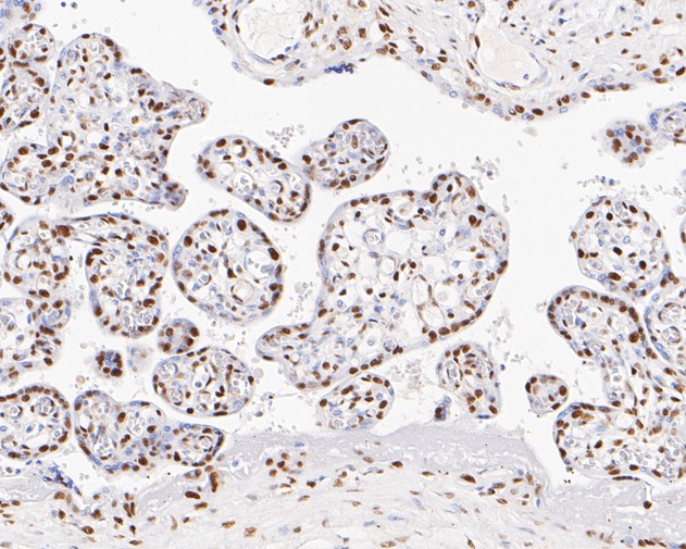 Immunohistochemical analysis of paraffin-embedded human placenta tissue with Rabbit anti-GTF2F2 antibody (ET7111-08) at 1/50 dilution.<br />
<br />
The section was pre-treated using heat mediated antigen retrieval with sodium citrate buffer (pH 6.0) for 2 minutes. The tissues were blocked in 1% BSA for 20 minutes at room temperature, washed with ddH2O and PBS, and then probed with the primary antibody (ET7111-08) at 1/50 dilution for 1 hour at room temperature. The detection was performed using an HRP conjugated compact polymer system. DAB was used as the chromogen. Tissues were counterstained with hematoxylin and mounted with DPX.
