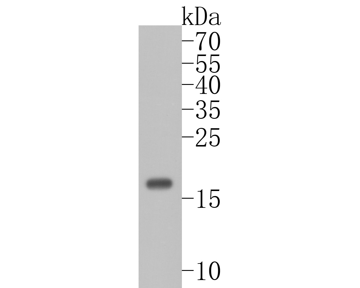 Western blot analysis of Ube2B on zebrafish tissue lysates. Proteins were transferred to a PVDF membrane and blocked with 5% BSA in PBS for 1 hour at room temperature. The primary antibody (ET7111-09, 1/500) was used in 5% BSA at room temperature for 2 hours. Goat Anti-Rabbit IgG - HRP Secondary Antibody (HA1001) at 1:5,000 dilution was used for 1 hour at room temperature.