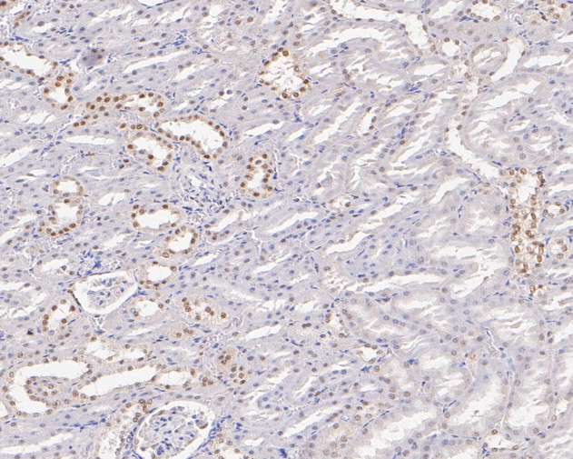 Immunohistochemical analysis of paraffin-embedded rat kidney tissue with Rabbit anti-TFII I antibody (ET7111-10) at 1/50 dilution.<br />
<br />
The section was pre-treated using heat mediated antigen retrieval with sodium citrate buffer (pH 6.0) for 2 minutes. The tissues were blocked in 1% BSA for 20 minutes at room temperature, washed with ddH2O and PBS, and then probed with the primary antibody (ET7111-10) at 1/50 dilution for 1 hour at room temperature. The detection was performed using an HRP conjugated compact polymer system. DAB was used as the chromogen. Tissues were counterstained with hematoxylin and mounted with DPX.