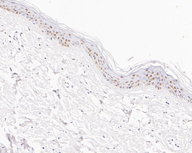 Immunohistochemical analysis of paraffin-embedded human skin tissue with Rabbit anti-TFII I antibody (ET7111-10) at 1/200 dilution.<br />
<br />
The section was pre-treated using heat mediated antigen retrieval with sodium citrate buffer (pH 6.0) for 2 minutes. The tissues were blocked in 1% BSA for 20 minutes at room temperature, washed with ddH2O and PBS, and then probed with the primary antibody (ET7111-10) at 1/200 dilution for 1 hour at room temperature. The detection was performed using an HRP conjugated compact polymer system. DAB was used as the chromogen. Tissues were counterstained with hematoxylin and mounted with DPX.