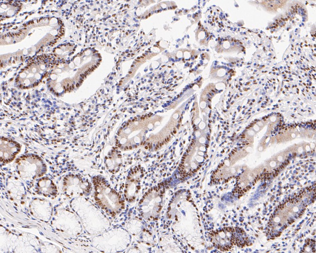 Immunohistochemical analysis of paraffin-embedded human small intestine tissue with Rabbit anti-TFII I antibody (ET7111-10) at 1/200 dilution.<br />
<br />
The section was pre-treated using heat mediated antigen retrieval with sodium citrate buffer (pH 6.0) for 2 minutes. The tissues were blocked in 1% BSA for 20 minutes at room temperature, washed with ddH2O and PBS, and then probed with the primary antibody (ET7111-10) at 1/200 dilution for 1 hour at room temperature. The detection was performed using an HRP conjugated compact polymer system. DAB was used as the chromogen. Tissues were counterstained with hematoxylin and mounted with DPX.