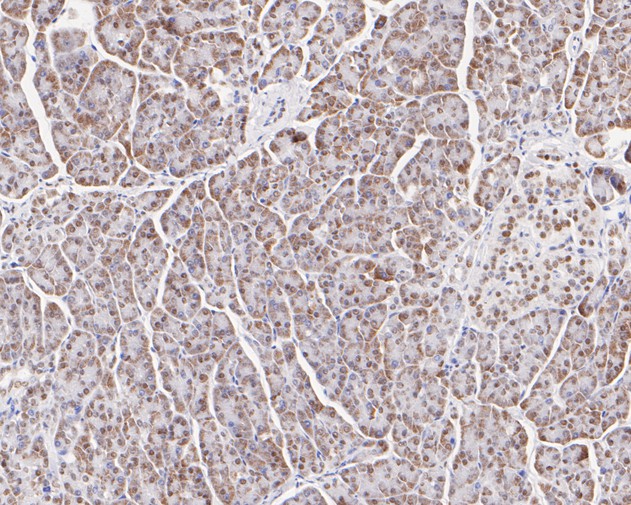 Immunohistochemical analysis of paraffin-embedded human pancreas tissue with Rabbit anti-TFII I antibody (ET7111-10) at 1/200 dilution.<br />
<br />
The section was pre-treated using heat mediated antigen retrieval with sodium citrate buffer (pH 6.0) for 2 minutes. The tissues were blocked in 1% BSA for 20 minutes at room temperature, washed with ddH2O and PBS, and then probed with the primary antibody (ET7111-10) at 1/200 dilution for 1 hour at room temperature. The detection was performed using an HRP conjugated compact polymer system. DAB was used as the chromogen. Tissues were counterstained with hematoxylin and mounted with DPX.